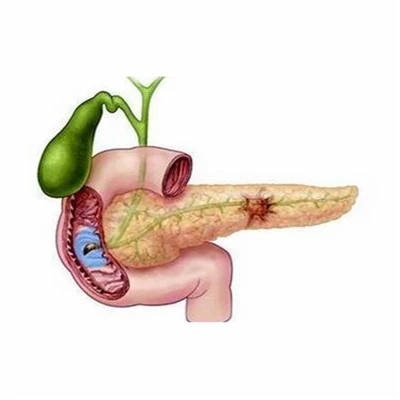 膵臓アイテム